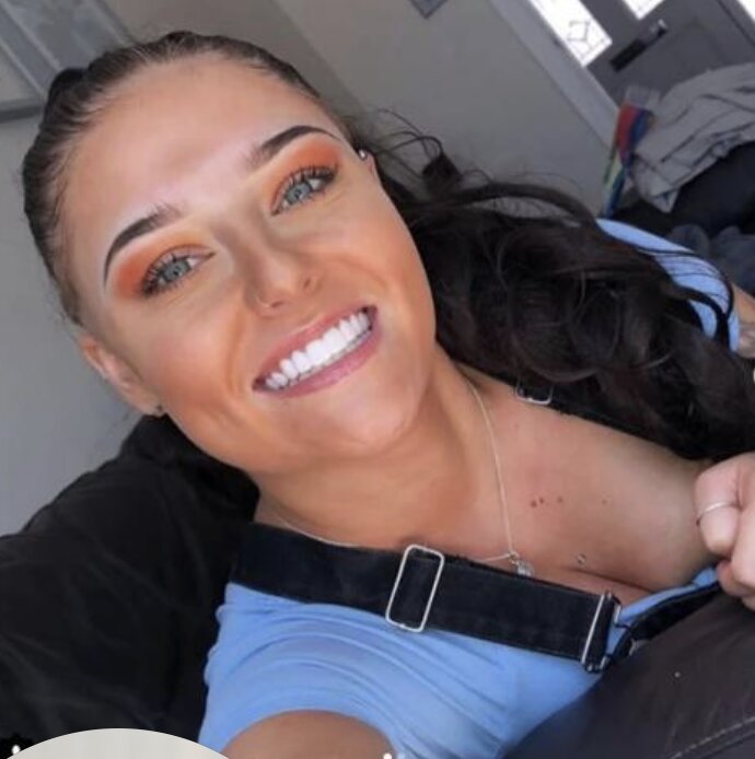 files/Review_4_Veneers.jpg